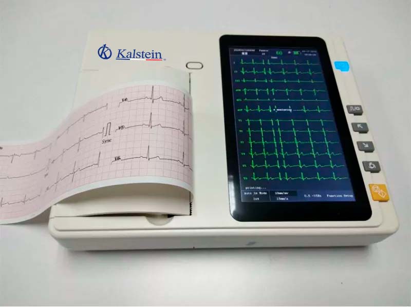 What is an electrocardiogram?
