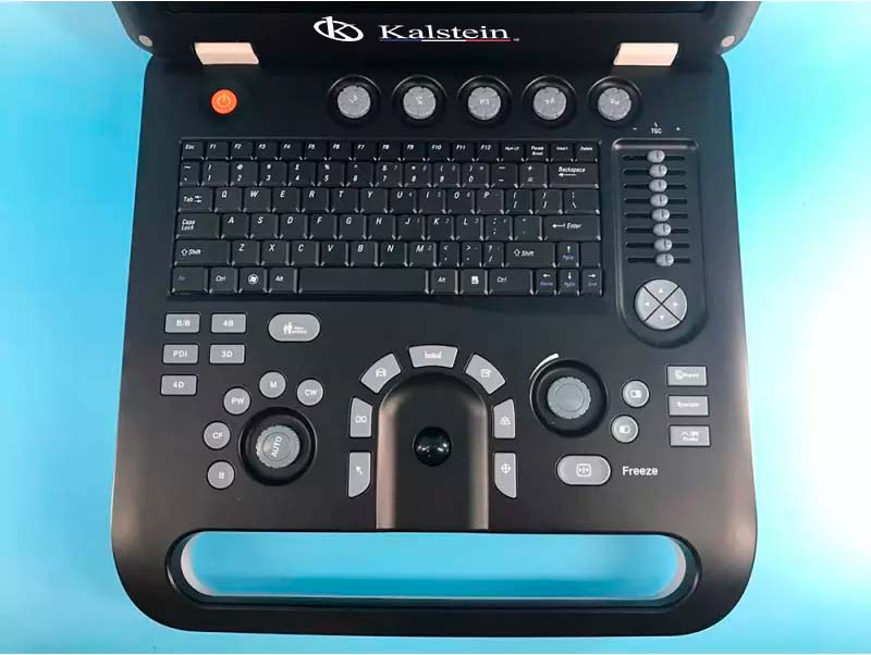 Unlocking the Power of Ultrasound Scanners: A Deep Dive into Kalstein's Offerings