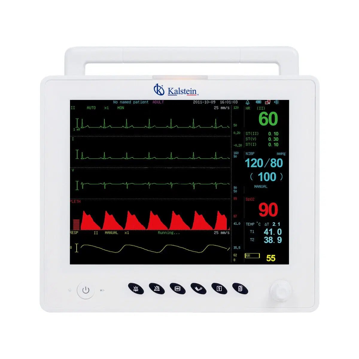 Design and Technology of Veterinary Monitors: Ensuring Patient Safety