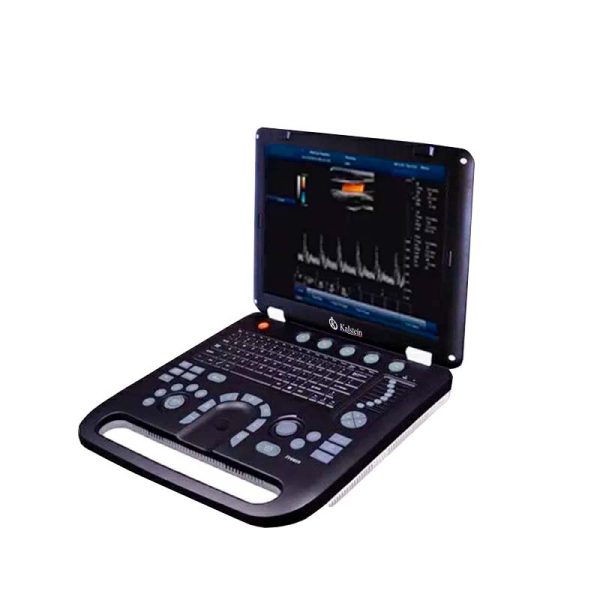 Revolutionizing Medical Imaging: The Remarkable Impact of Ultrasound Scanners